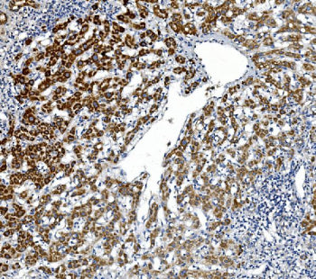 Immunohistochemical staining of GPNMB using anti-GPNMB antibody. GPNMB was detected in paraffin-embe