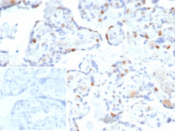 IHC staining of FFPE human bladder tissue with p57Kip2 antibody. Strong nuclear staining using rKIP2