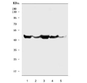 Western blot testing of 1) human HepG2, 2) human HeLa, 3) human A549, 4) rat skeletal muscle and 5) 