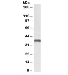 Western blot testing of U937 lysate with CLL-1 antibody at 0.3ug/ml. Predicted molecular weight: ~31