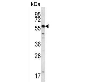 Western blot testing of human NCI-H292 cell lysate with SMYD2 antibody. Predicted molecular weight ~
