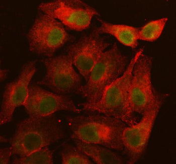 Immunofluorescent staining of LRIF1 using anti-LRIF1 antibody (green) and anti-Beta Tubulin antibody