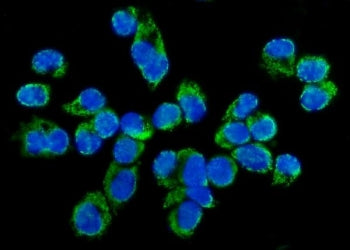 TARS2 Antibody / TARSL1