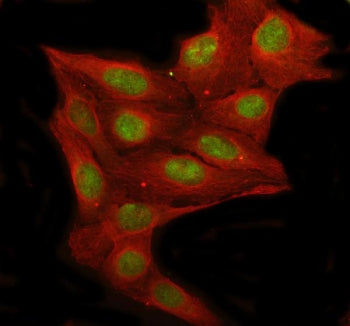 Immunofluorescent staining of FFPE human U-2 OS cells with RFC1 antibody (green) and Beta Tubulin mA