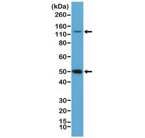 Western blot testing of HeLa cell lysate with recombinant NFKB1 antibody at 1:100 dilution. Expected