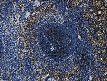 IHC staining of FFPE rat spleen tissue with Cd4 antibody. HIER: boil tissue sections in pH8 EDTA for
