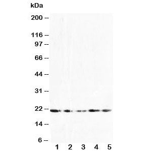 Western blot testing of FGF10 antibody and Lane 1: U87; 2: HeLa; 3: A549; 4: 293T; 5: HeLa cell lysa