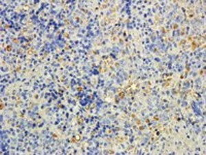 MTMR9 Antibody