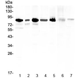 Western blot testing of human 1) U-87MG, 2) U-2 OS, 3) HeLa, 4) 22RV1, 5) K562, 6) rat liver and 7) 
