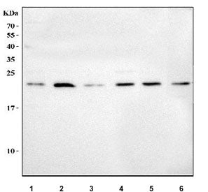 MSRB3 Antibody / Methionine-R-sulfoxide reductase B3
