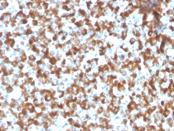 IHC staining of FFPE human pituitary tissue with recombinant FSH beta antibody (clone FSHb/2033R). H
