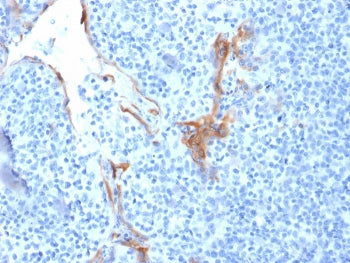 IHC staining of FFPE human tonsil with Cytokeratin 16 antibody (clone LL025). HIER: boil tissue sect