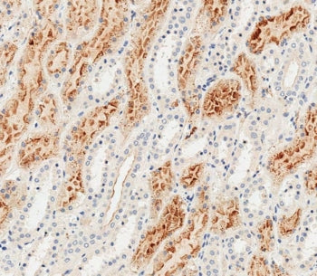 IHC testing of FFPE human kidney tissue with Folate Receptor alpha antibody. HIER: steam section in 