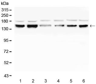 Western blot testing of human 1) K562, 2) HL60, 3) ThP-1, 4) Raji, 5) HeLa and 6) HepG2 cell lysate 