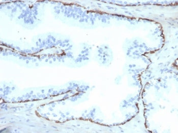 Cytokeratin 14 Antibody / CK14 / KRT14