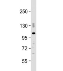 PDE2A Antibody / Phosphodiesterase 2A
