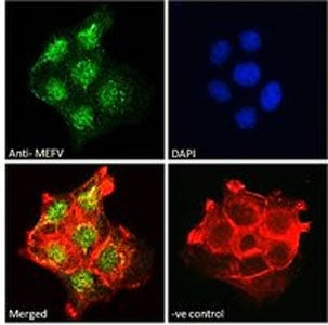 IF/ICC staining of fixed and permeabilized human A431 cells with GADD34 antibody (green) at 10ug/ml,