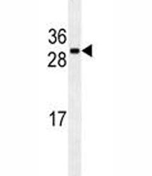 CDCA8 Antibody, 0.08ml
