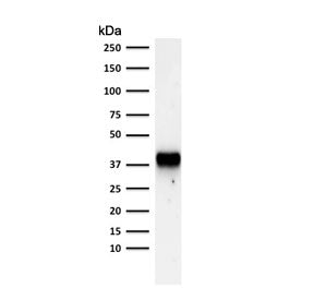 Western blot testing of human PC3 cell lysate with AMACR antibody. Predicted molecular weight ~43 kD