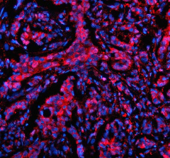 Immunofluorescent staining of MTMR3 using anti-MTMR3 antibody (red). MTMR3 was detected in a paraffi