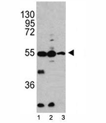 Caspase-2 Antibody, 0.4ml