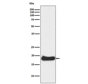 Western blot testing of human A431 cell lysate with CLDN1 antibody. Expected molecular weight: 20-23