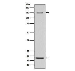 Western blot testing of mouse heart lysate with ITGA5 antibody. Expected molecular weight: 115-160 k