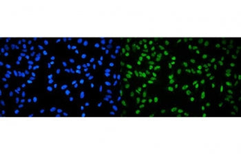 Immunofluorescent staining of FFPE human HeLa cells with RPA32 antibody (green) and DAPI nuclear sta