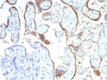 IHC staining of FFPE human tonsil tissue with recombinant CD21 antibody (clone rCR2/6964). Inset: PB