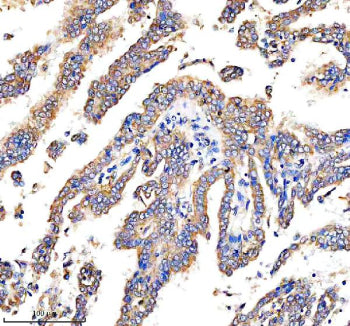 Immunohistochemical staining of DEPDC6/DEPTOR using anti-DEPTOR antibody. DEPDC6/DEPTOR was detected
