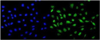 Immunofluorescent staining of FFPE human U-2 OS cells with MCAK antibody (green) and DAPI nuclear st