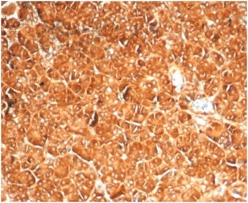 IHC staining of FFPE human pancreas with recombinant Vinculin antibody (clone VCL/7091R) at 2ug/ml. 