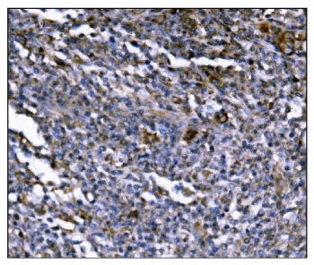 IHC staining of FFPE human lymphoma tissue with ERAP2 antibody. HIER: boil tissue sections in pH8 ED