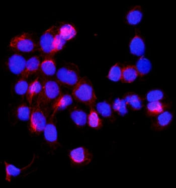 Immunofluorescent staining of FFPE human A431 cells with SHMT1 antibody (red) and DAPI nuclear stain