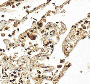 IHC staining of FFPE human liver tissue with Hexokinase 3 antibody, HRP-secondary and DAB substrate.