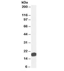 Western blot testing of human duodenum lysate with AGR2 antibody at 0.01ug/ml. Expected molecular we