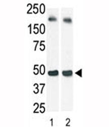 The SphK1 antibody used in western blot (lane 2) to detect c-myc-tagged SphK1 in transfected 293 cel