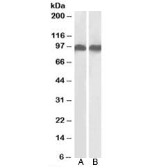 Western blot testing of human A) K562 and B) U937 cell lysates with LFA-1 antibody at 0.3ug/ml. Pred