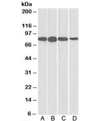 Western blot of mouse NIH3T3 (A), and human HeLa (B), Jurkat (C), and A431 (D) lysates with Radixin 