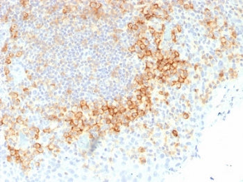 IHC testing of FFPE human tonsil tissue with recombinant CD27 antibody (clone rLPFS2/1611). Required