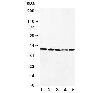Western blot testing of CCR10 antibody and Lane 1: HeLa; 2: SW620; 3: A549; 4: MM231; 5: SMMC-7721 c