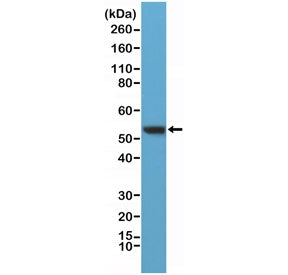Western blot testing of human HeLa lysate with recombinant Vimentin antibody at 1:400 dilution. Pred