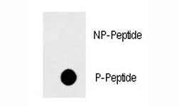 Dot blot analysis of phospho-Fas antibody. 50ng of phos-peptide or nonphos-peptide per dot were spot