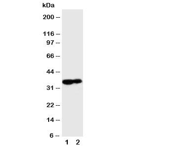 Western blot testing of Kallikrein 9 antibody and Lane 1: MCF-7; 2: A431 cell lysate