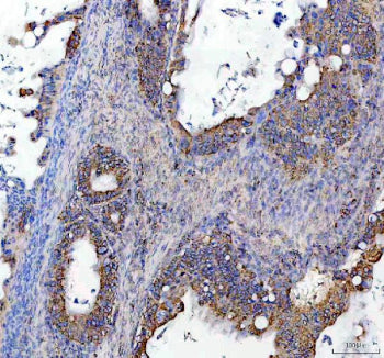 IHC staining of FFPE human ovarian tissue with SOCS5 antibody, HRP-secondary and DAB substrate. HIER