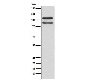 Western blot testing of human HeLa cell lysate with p120 Catenin antibody. Predicted molecular weigh