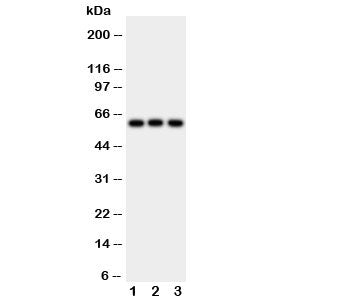 Western blot testing of HEXA antibody and Lane 1: rat liver; 2: human HeLa; 3: (h) SMMC-7721 cell ly