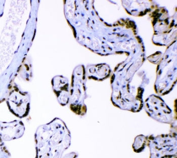 AFF4 Antibody / AF4/FMR2 family member 4