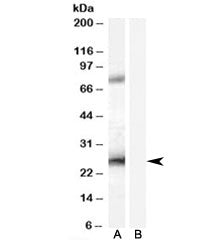 Western blot testing of A431 lysate with EBAG9 antibody at 0.2ug/ml with [B] and without [A] blockin
