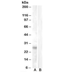 Western blot testing of heart lysate with RASSF3 antibody at 0.5ug/ml with [B] and without [A] immun